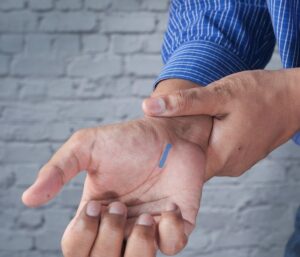 Carpal Tunnel Surgery Portland Dr. Jenq