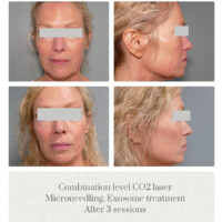 Laser Skin Solutions Portland OR